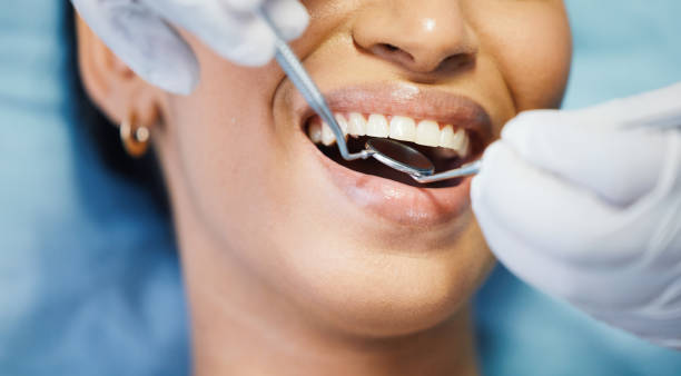 Best Tooth Pain Emergency Relief  in Hunters Creek Village, TX