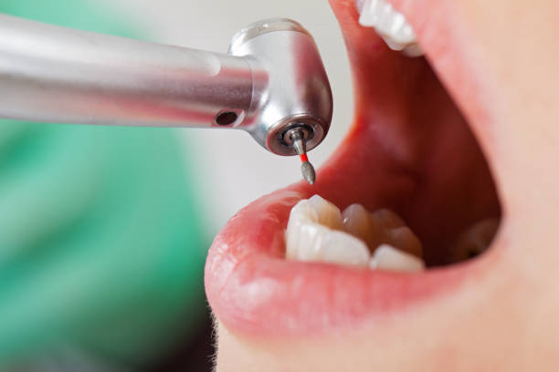 Best Knocked-Out Tooth Emergency  in Hunters Creek Village, TX